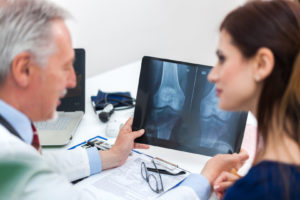Osteoporosis and Cellercise Rebound Exercise