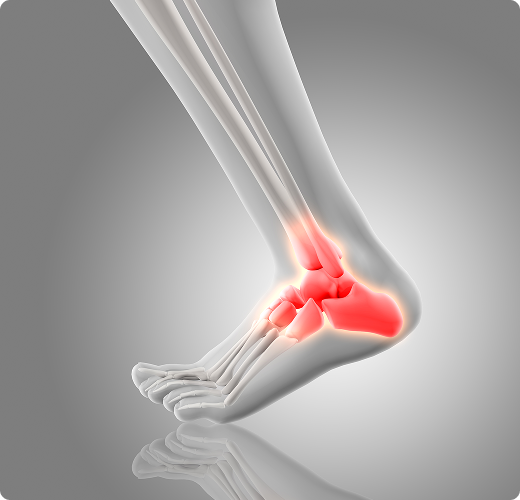 Anatomical illustration of a foot with a highlighted ankle joint